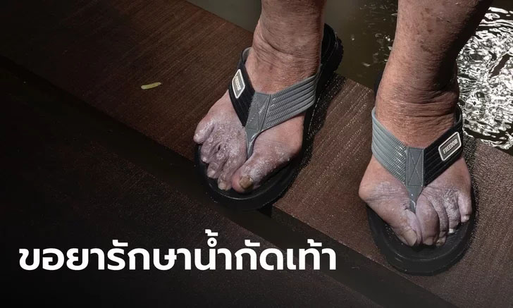 น้ำท่วมนนทบุรี ชาวบ้านร้องขอยารักษา "โรคน้ำกัดเท้า" คุณยายโชว์เท้าเป็นขนาดนี้แล้ว